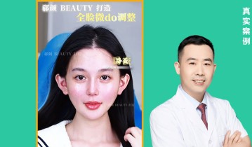 𝐃𝐫 ·李正和院长｜全脸微调案例✨ 高级感+幼态感双在线！