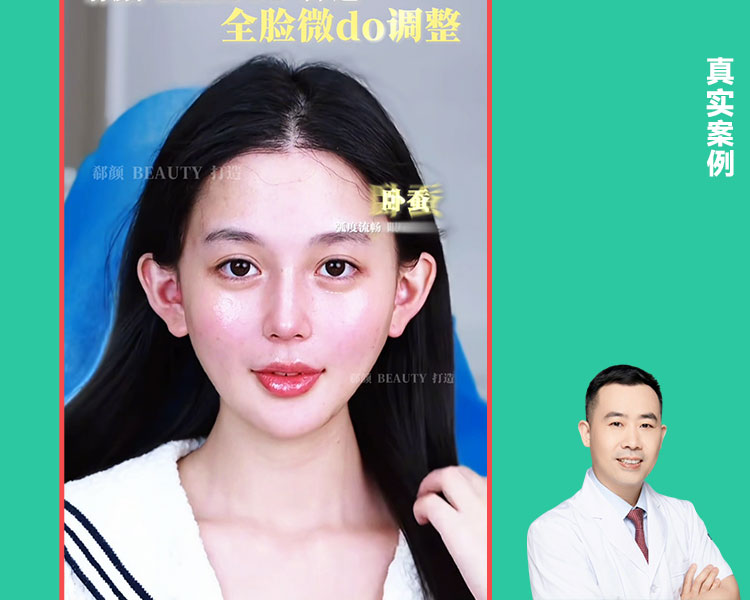 𝐃𝐫 ·李正和院长｜全脸微调案例✨ 高级感+幼态感双在线！