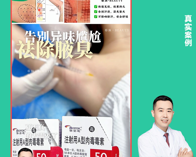 𝐃𝐫 ·李正和院长 别再被狐臭、腋下多汗困扰啦！止汗针💉轻松改善异味案例